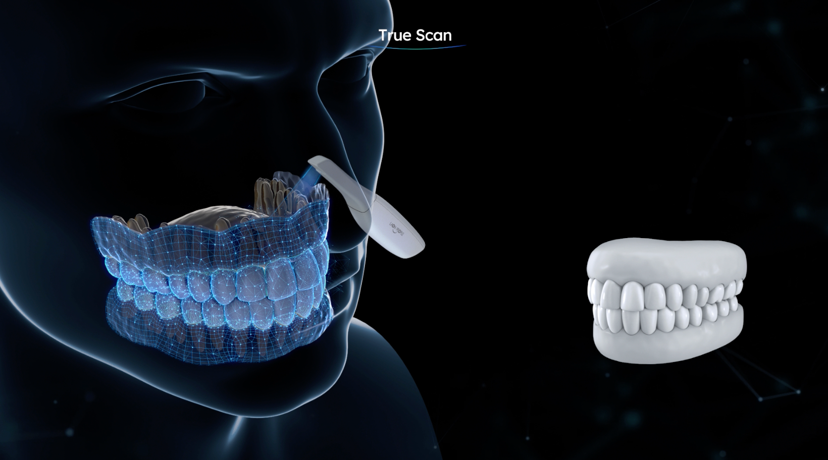 덴탈소프트웨어 GUI 개발 2차 & SIDEX 전시 영상 gallery image 1