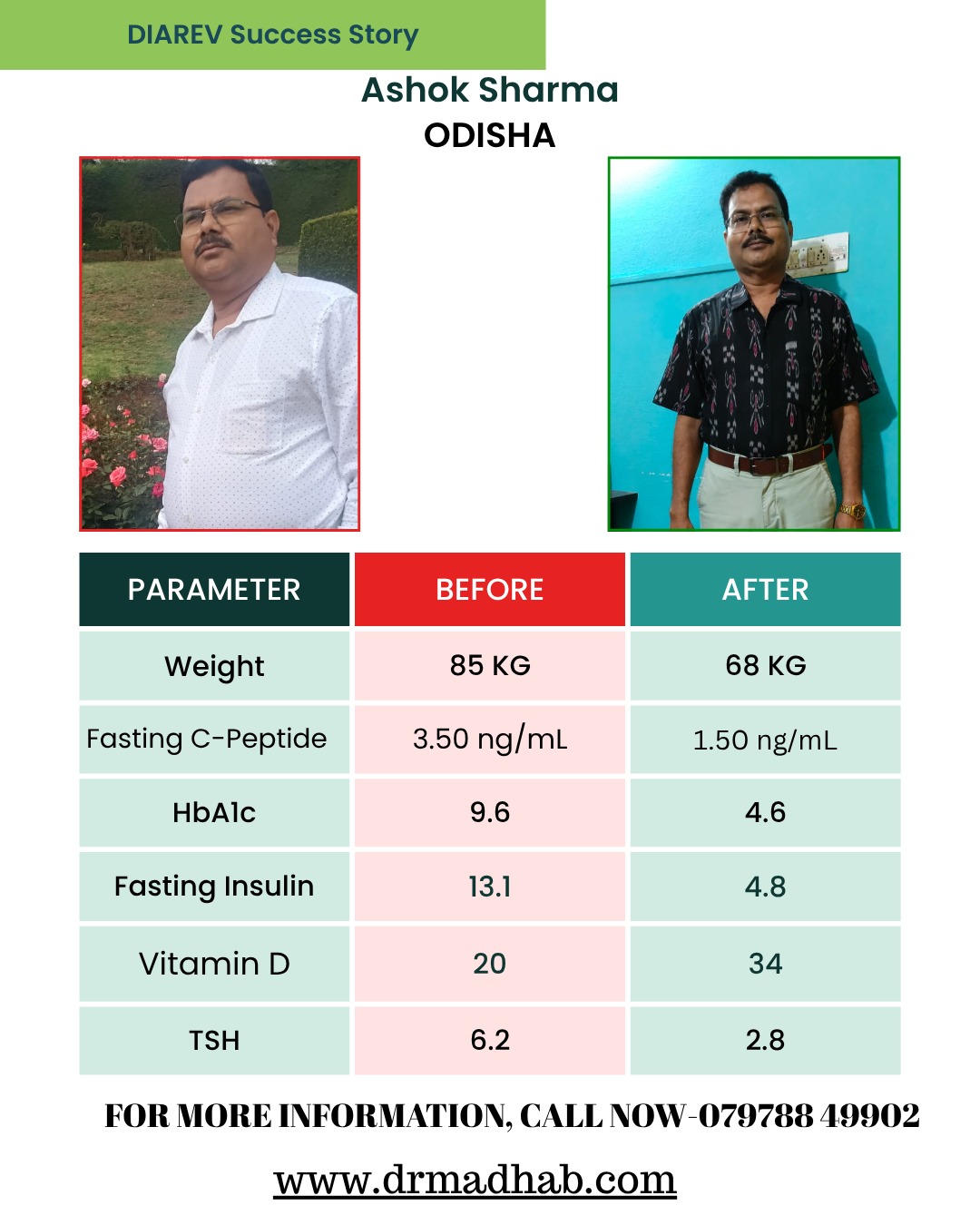 Reversing Diabetes: A Journey from 9.6% to 4.6% HbA1c