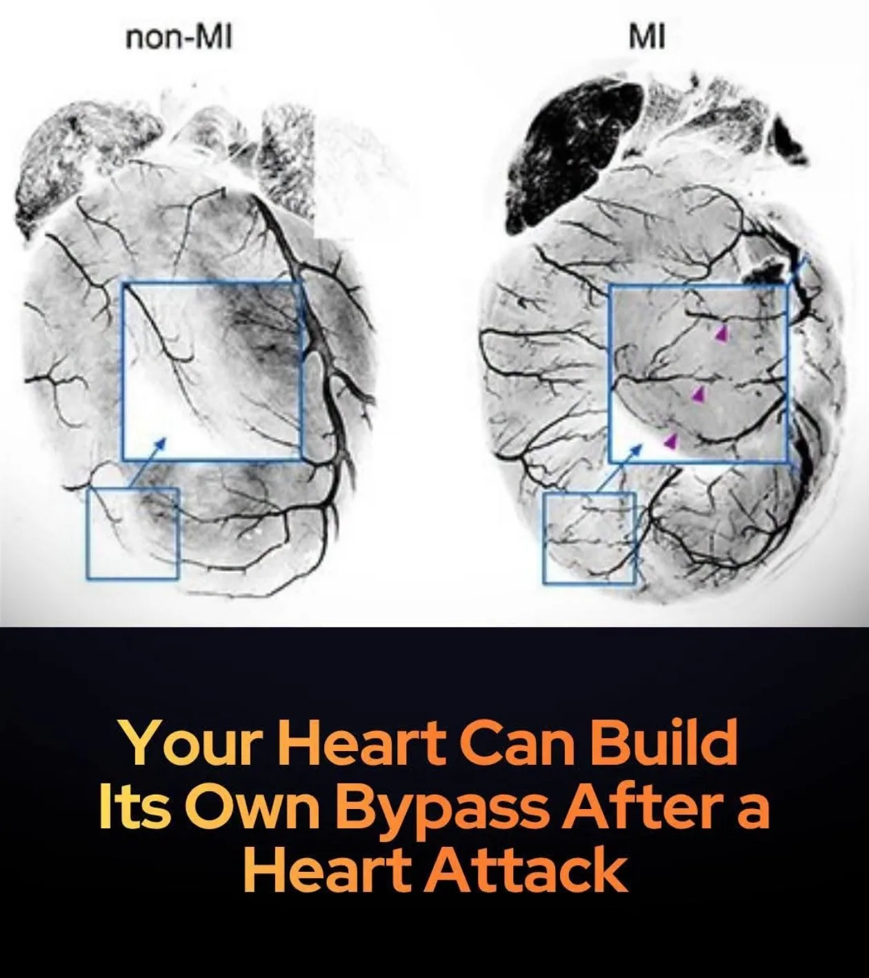 Heart image