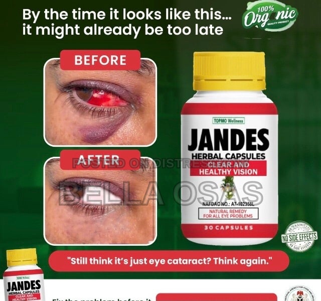 Jandes herbal capsule eye cleanser 