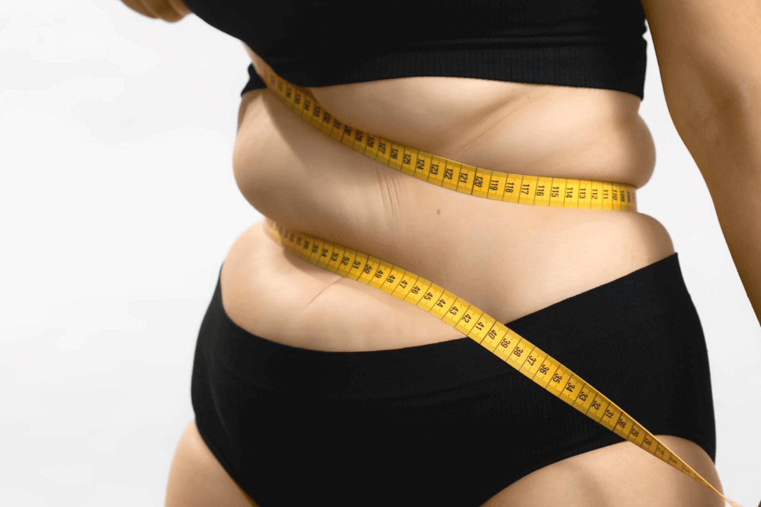 Gastric Sleeve Surgery
