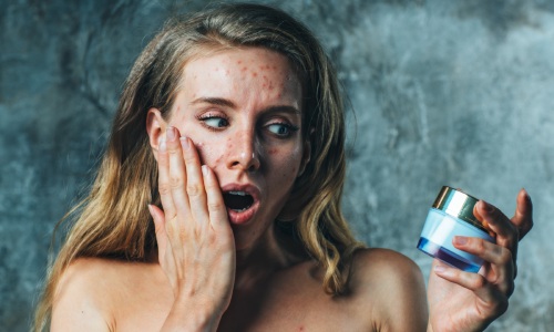 Mengenali Ciri Kulit Sensitif & Cara Mengatasinya - DoctorOnCallPost