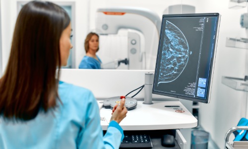 Breast Cancer Screening | What Is Mammogram? - DoctorOnCall