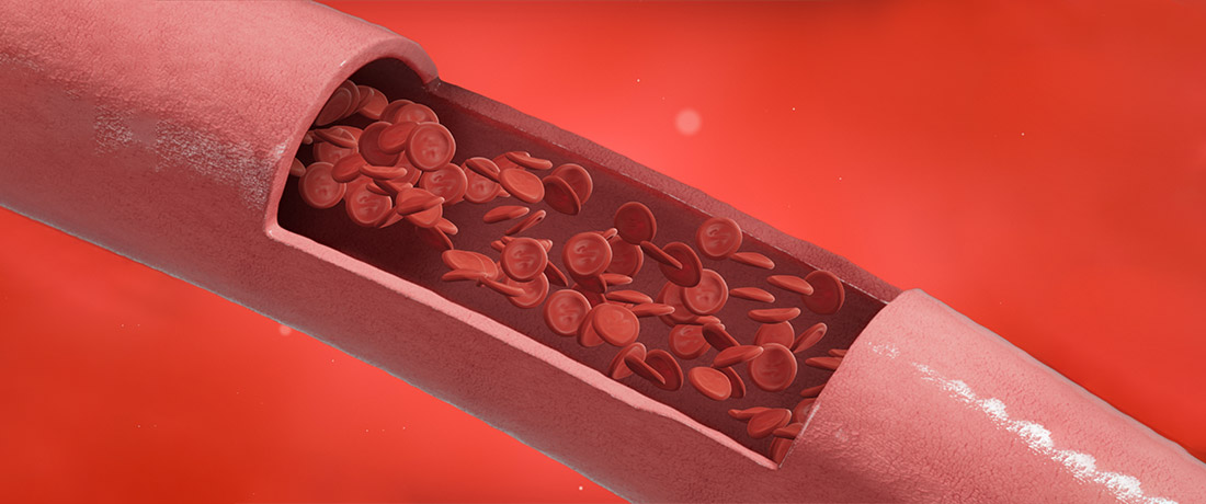 Sistem Peredaran Darah Manusia: Kenali Tubuh Anda - DoctorOnCall