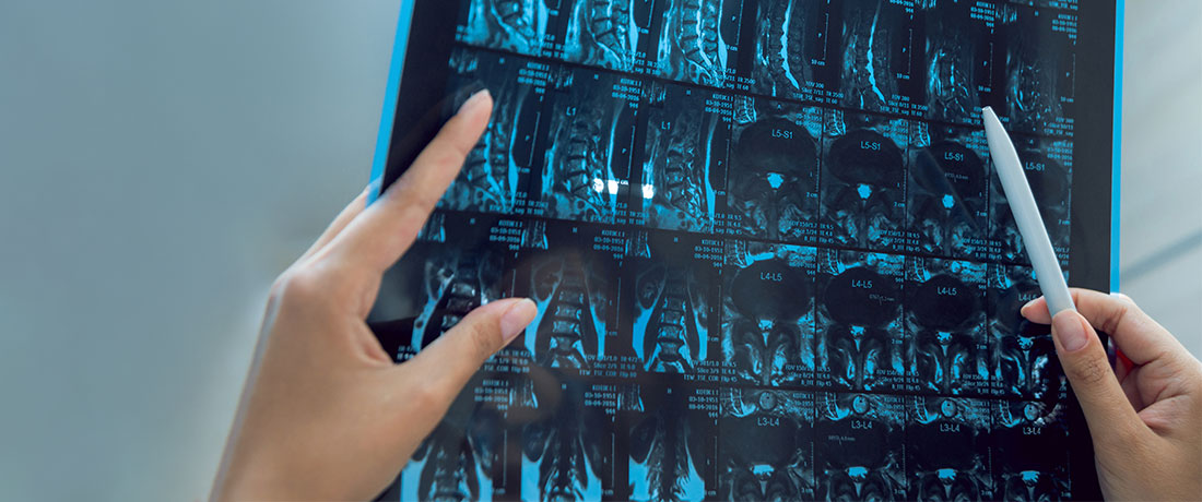 CT Angiogram: The Importance of Heart Screening - DoctorOnCall