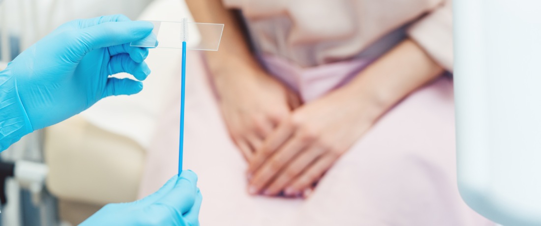 Kenapa Ujian Pap Smear Penting untuk Kanser Serviks? - DoctorOnCall