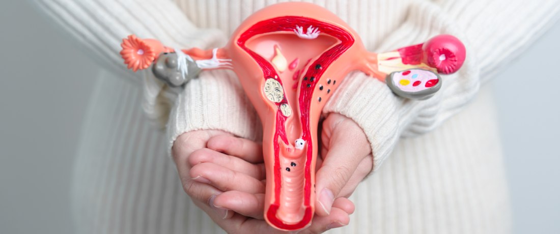 Kanser Ovari Vs Sista Ovari: Memahami Perbezaannya - DoctorOnCall