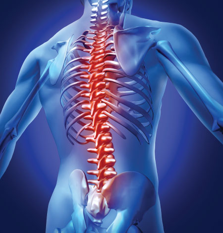 Spine Surgery