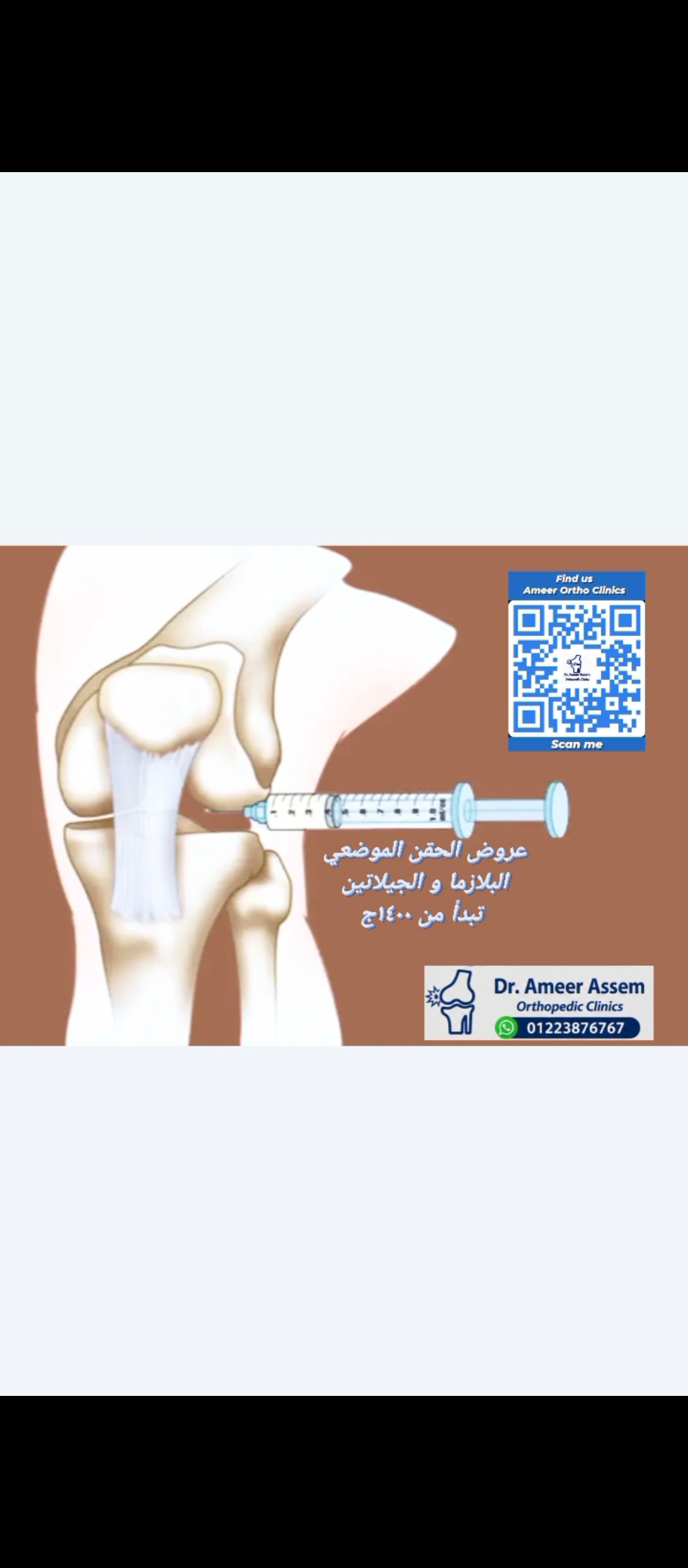 Local injection