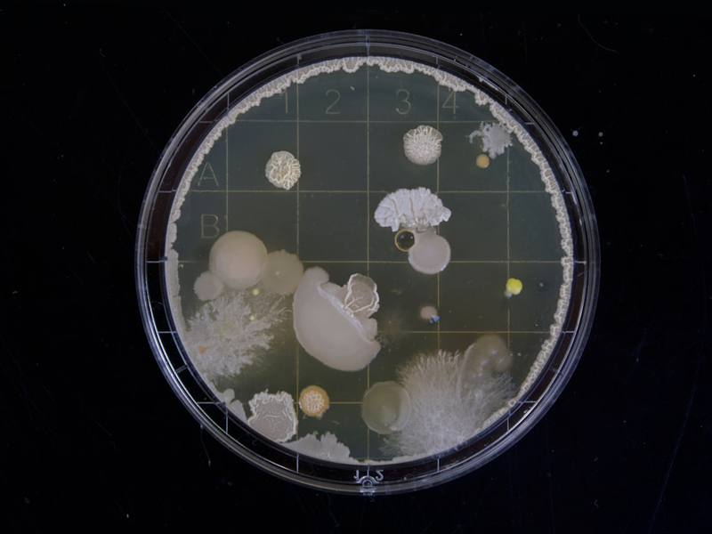 A friend of mine had to do some bacteria samples during her bachelor thesis. When i saw those i was instantly fascinated by the vast range of variation within this tiny microcosm.