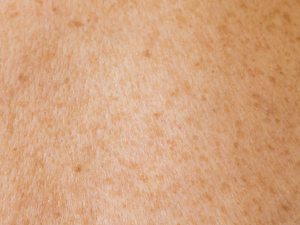 Human skin texture with freckles