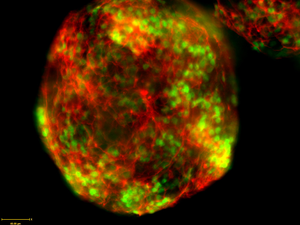 CRISPR/Cas9 in Neurons