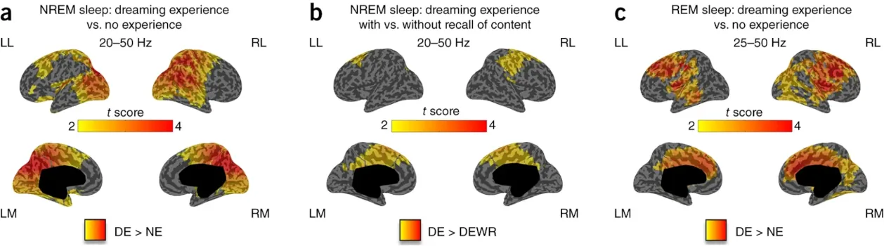 Dreaming Tononi