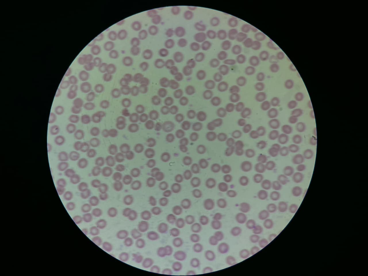 DS DNA Diagnosis microscopic analysis
