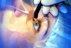 Ophthalmologist