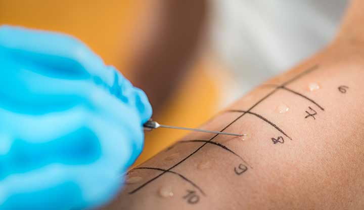 Allergist