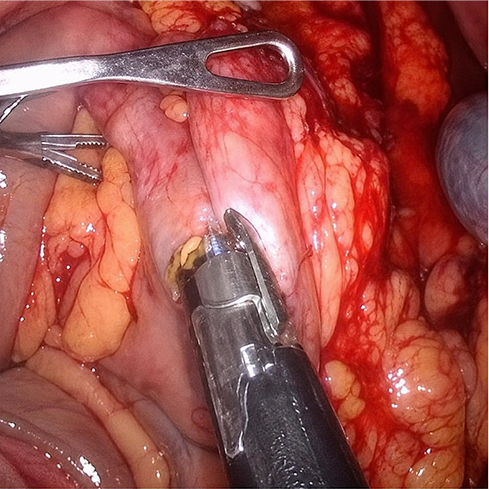 Anatomia em procedimento laparoscópico