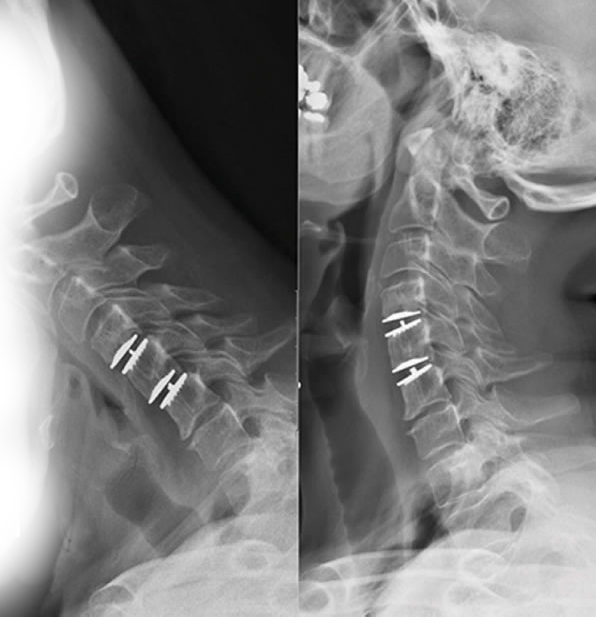 Radiografias da coluna cervical
