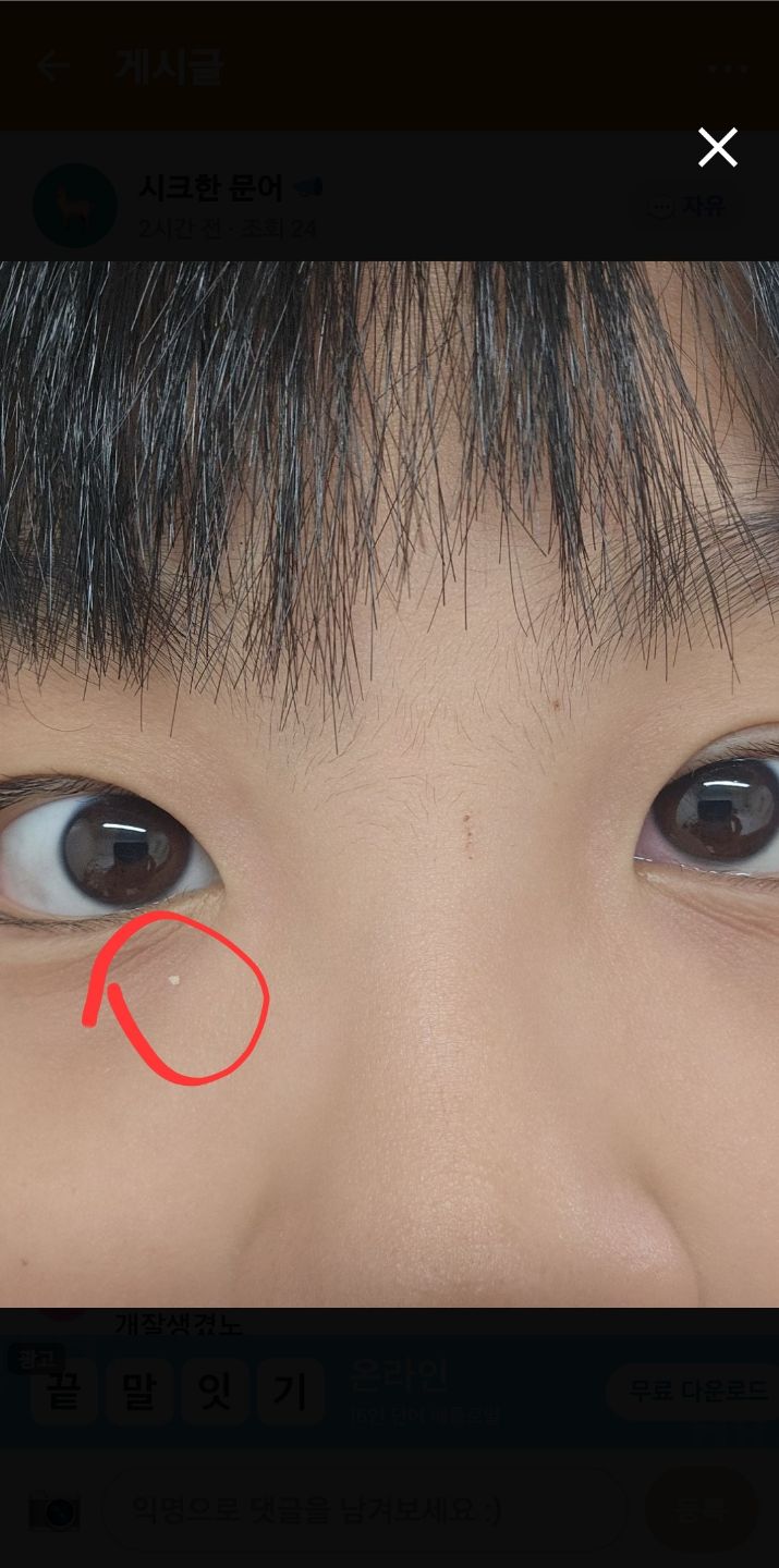 댓글 첨부 이미지
