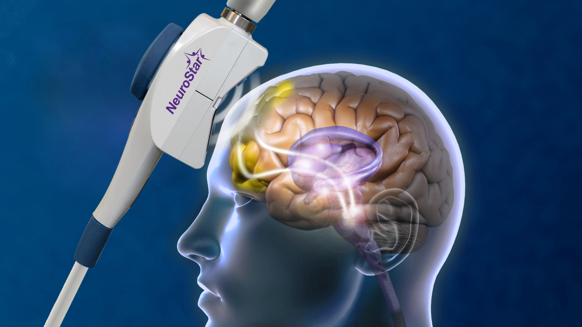 HP Lateral Head Coil