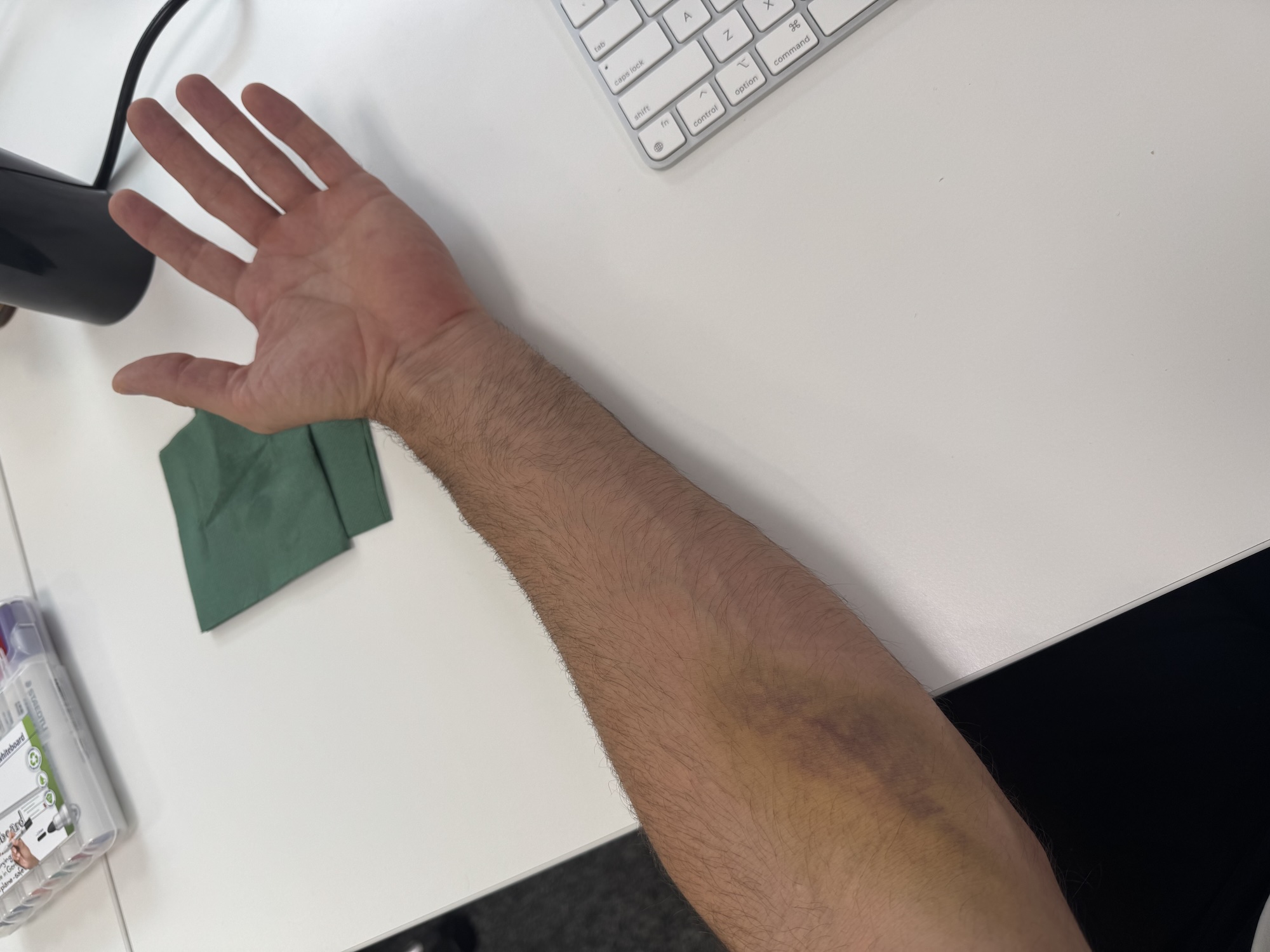 arm.jpg