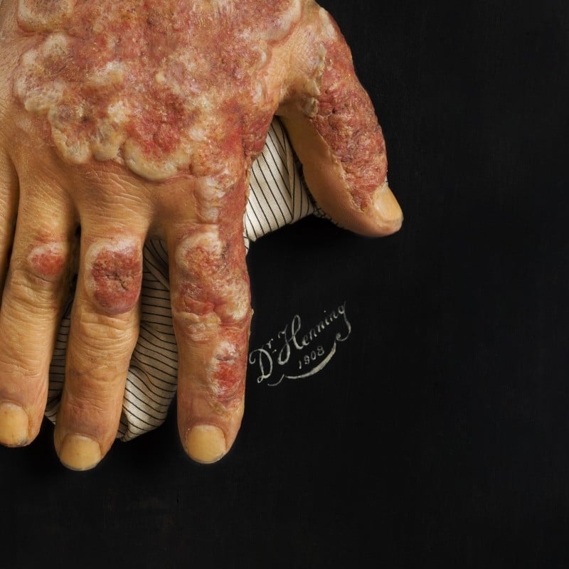 Die Kunst der Moulage