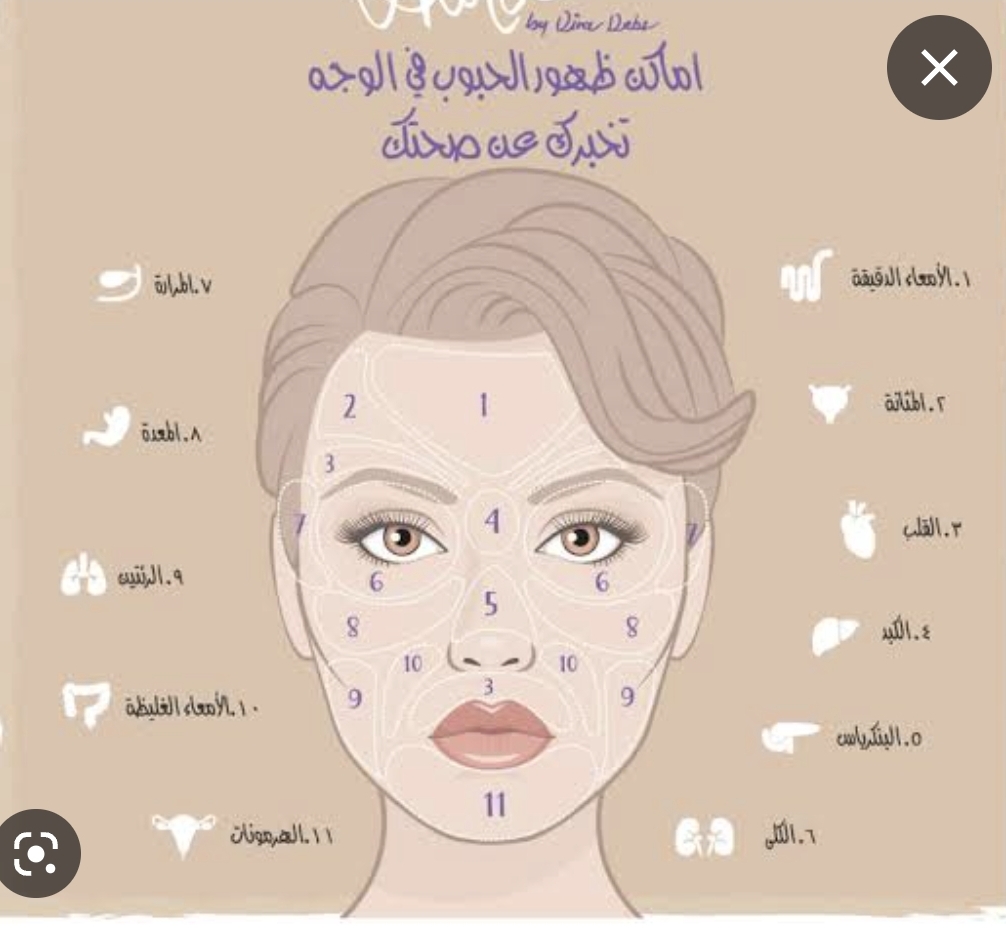 انواع حب الشباب وبعض اسباب ظهور الحبوب