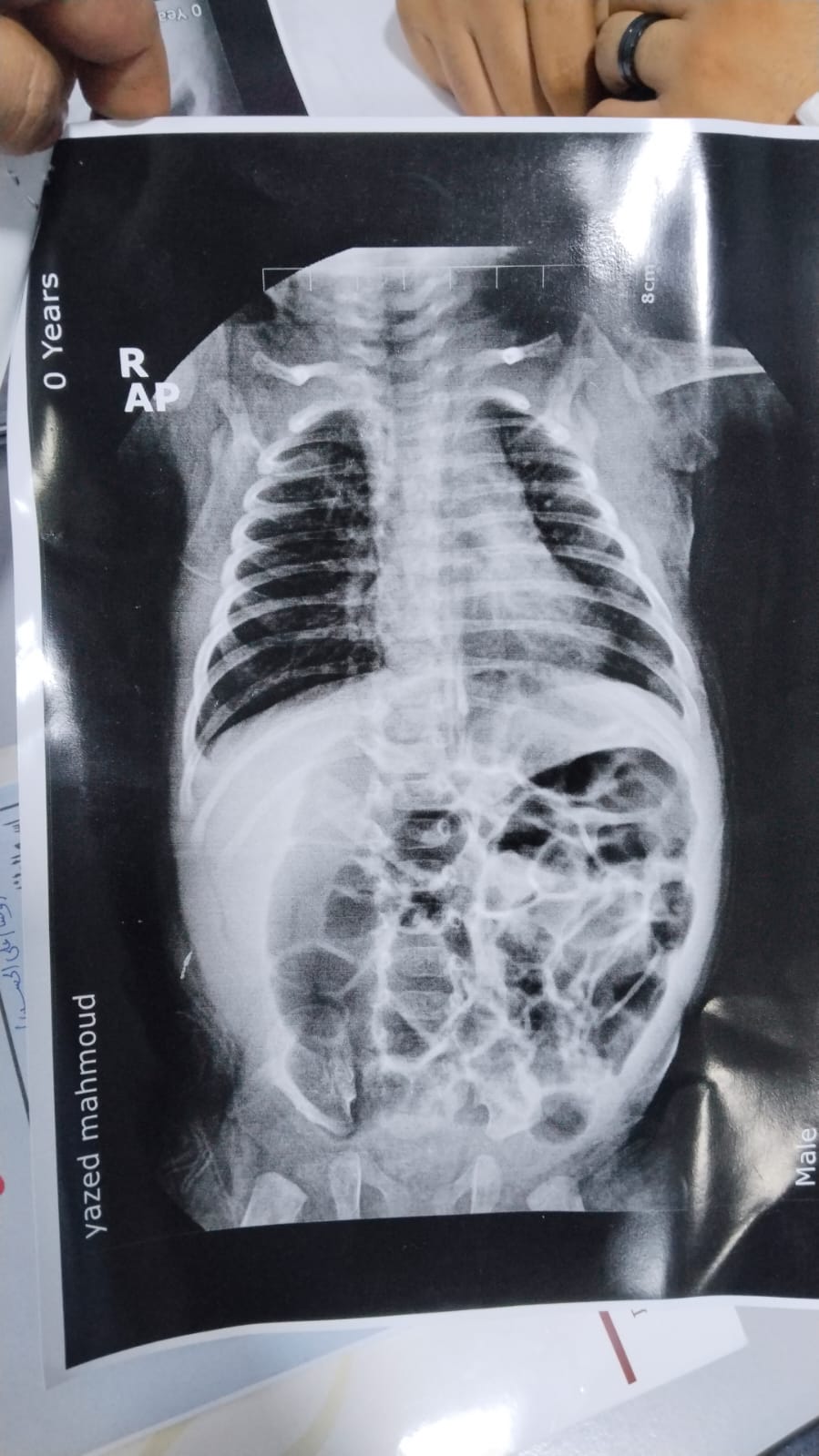 ما تفاصيل هذه الأشعة؟