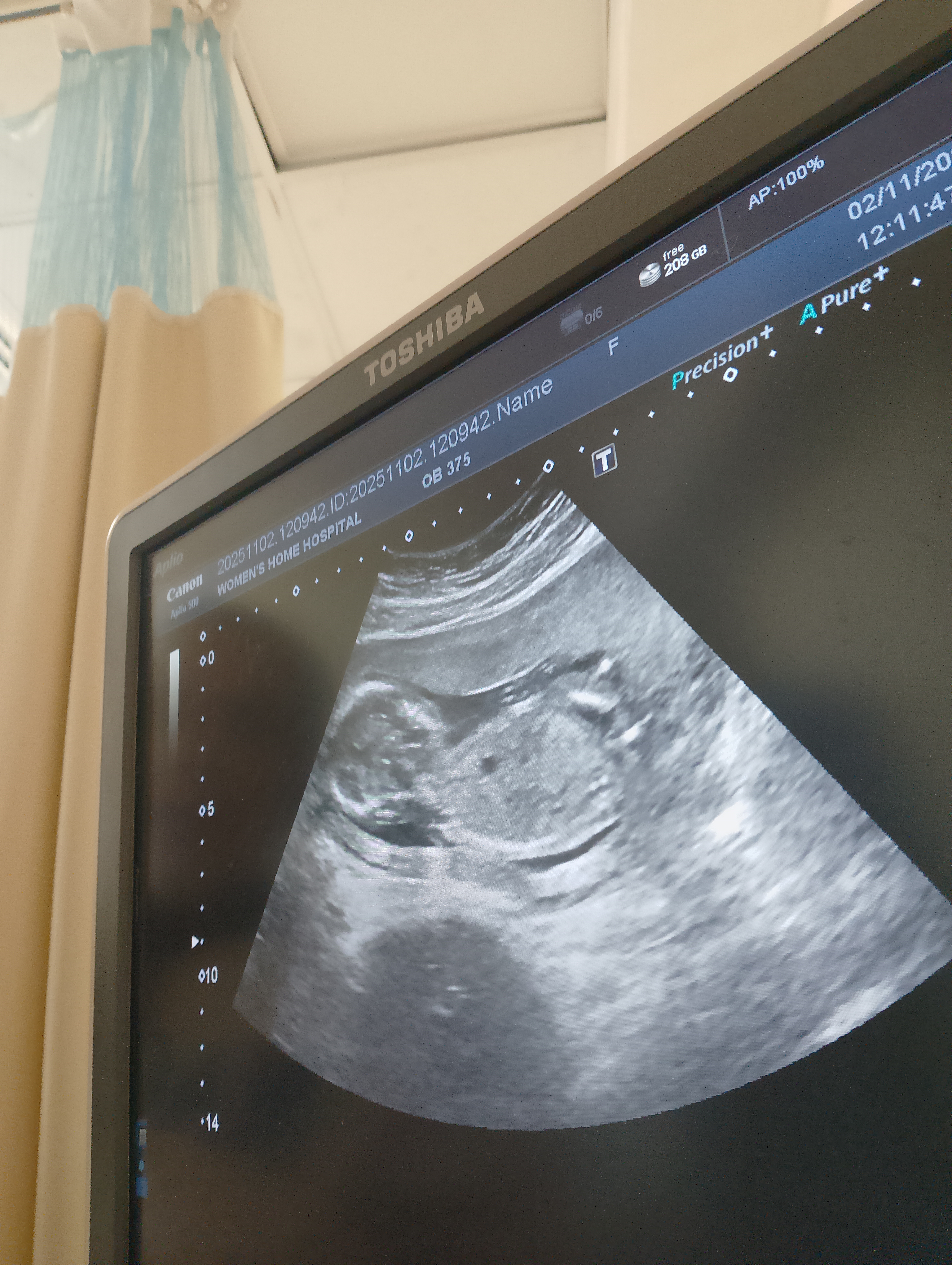 هل هذا الجنين ولد أو بنت؟