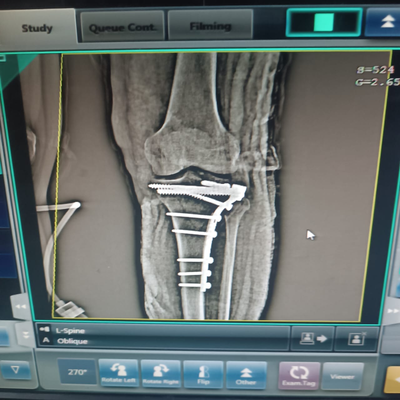 هل يوجد فرق بين صورتي الأشعة؟