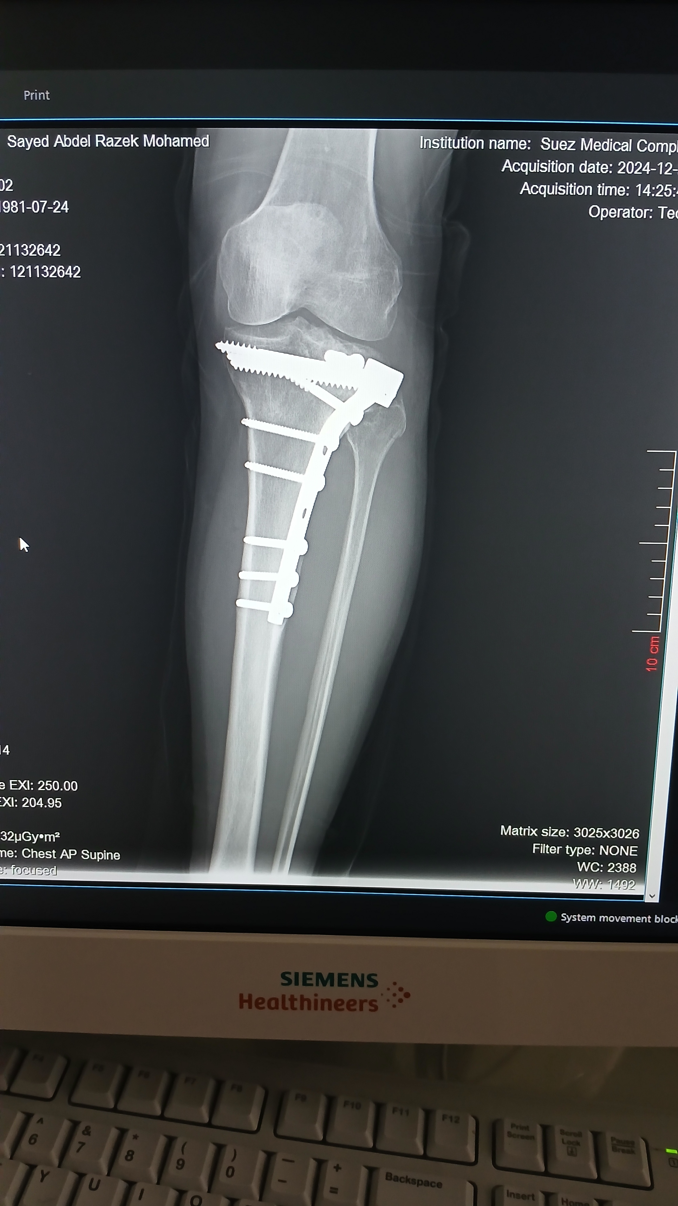 دي صورتين القديمه والجديده