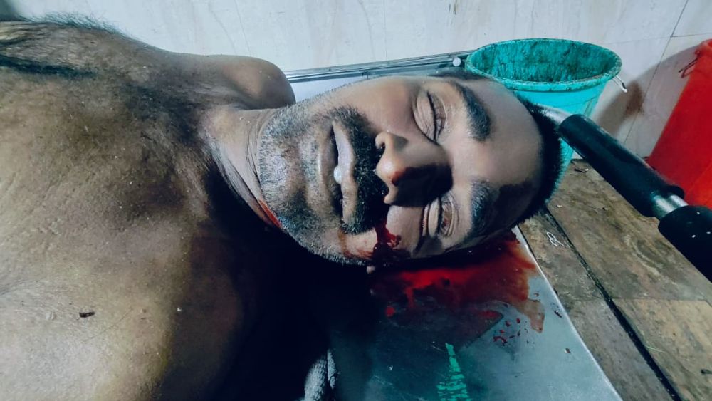 बेवारस इसम शाहूनगर पोलीस ठाणे हद्दीमध्ये नूर हॉटेल समोर सन्नऊला कंपाऊंड येथे बेशुद्ध अवस्थेत मिळून आल्याने त्यास पोलिसांच्या मदतीने ॲम्ब्युलन्सद्वारे  सायन रुग्णालयात उपचारासाठी नेले असता डॉक्टरांनी दाखलपूर्व मयत घोषित केले