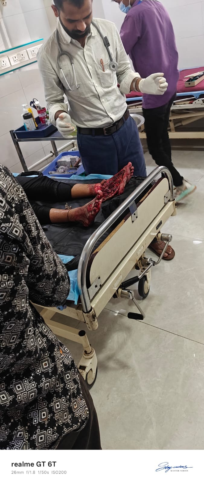 काशीगांव दरगा रोड पर स्थित RMC(रेडी मिक्स कंक्रीट) प्लांट की गाड़ी ने शनिवार की सुबह आठ बजे काशीगांव ग्रीन विलेज के पास पैदल जा रही युवती के दोनों पैरो को बुरी तरह से कुचल दिया।