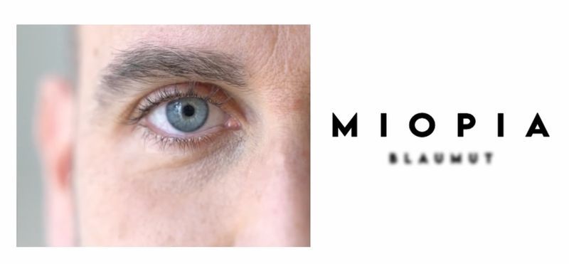 Miopia 2