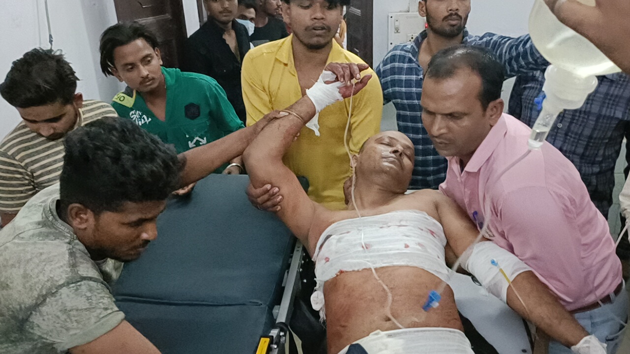 व्यवसायी को अपराधियों ने मारी गोली,स्थिति गंभीर।