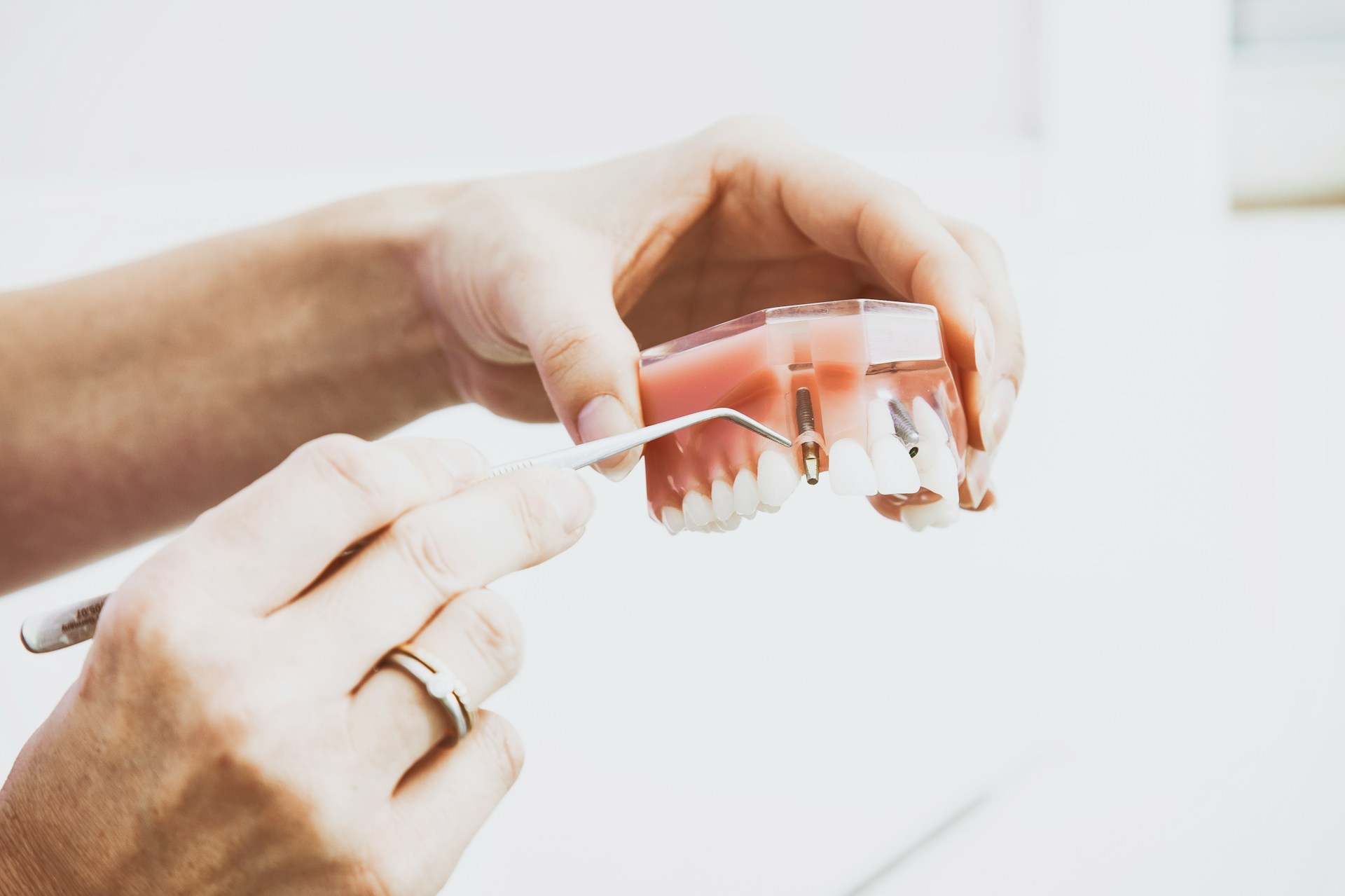 Image for Surgical Extraction