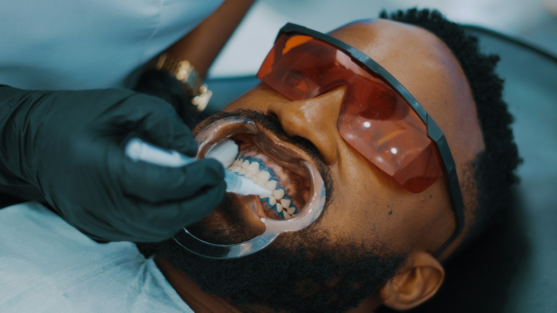 Image for Teeth Whitening