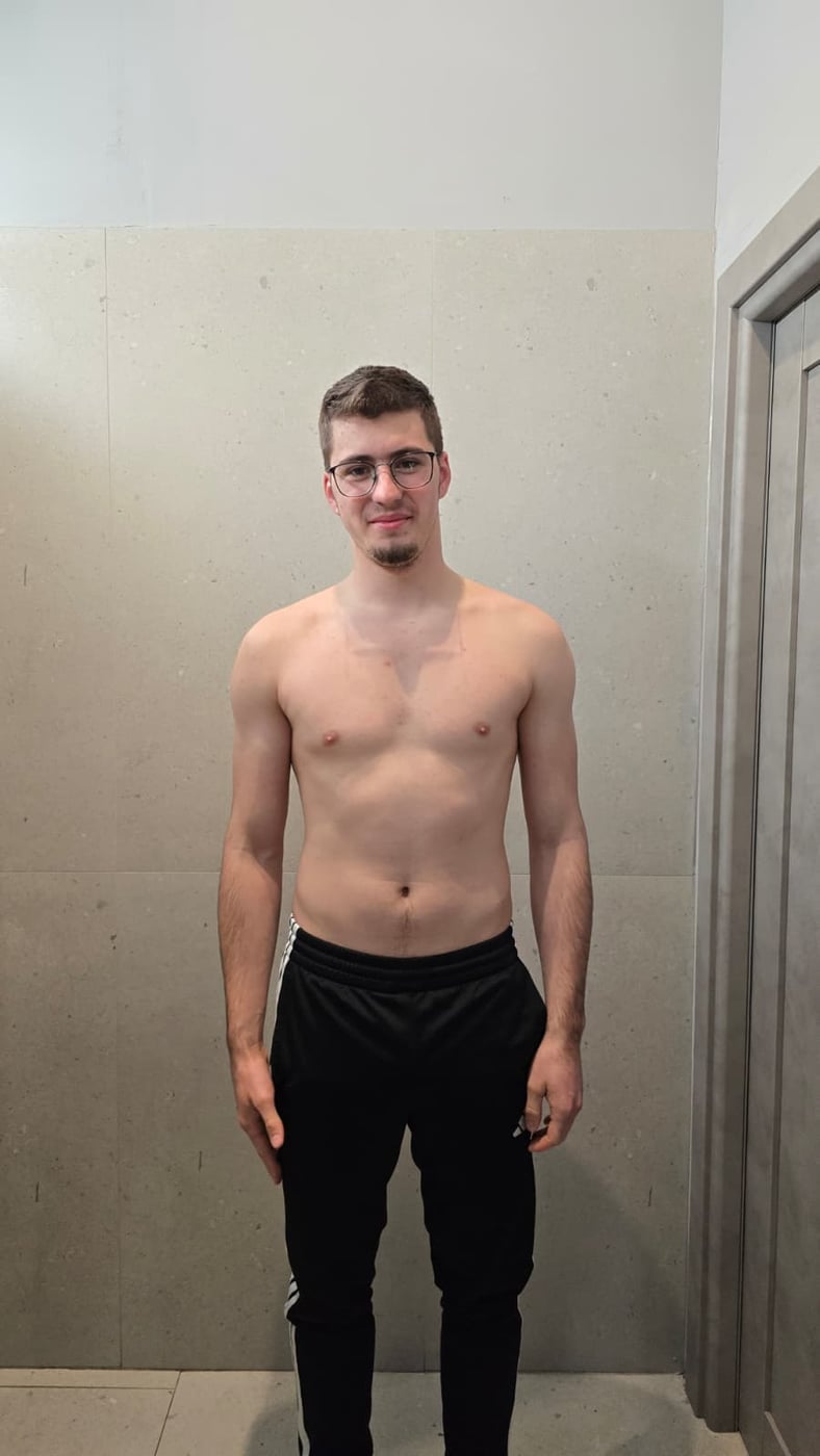 Before
