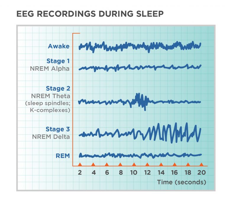 psychology sleep assignment