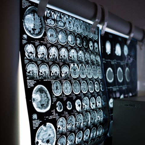 medical-imaging-memory-consolidation