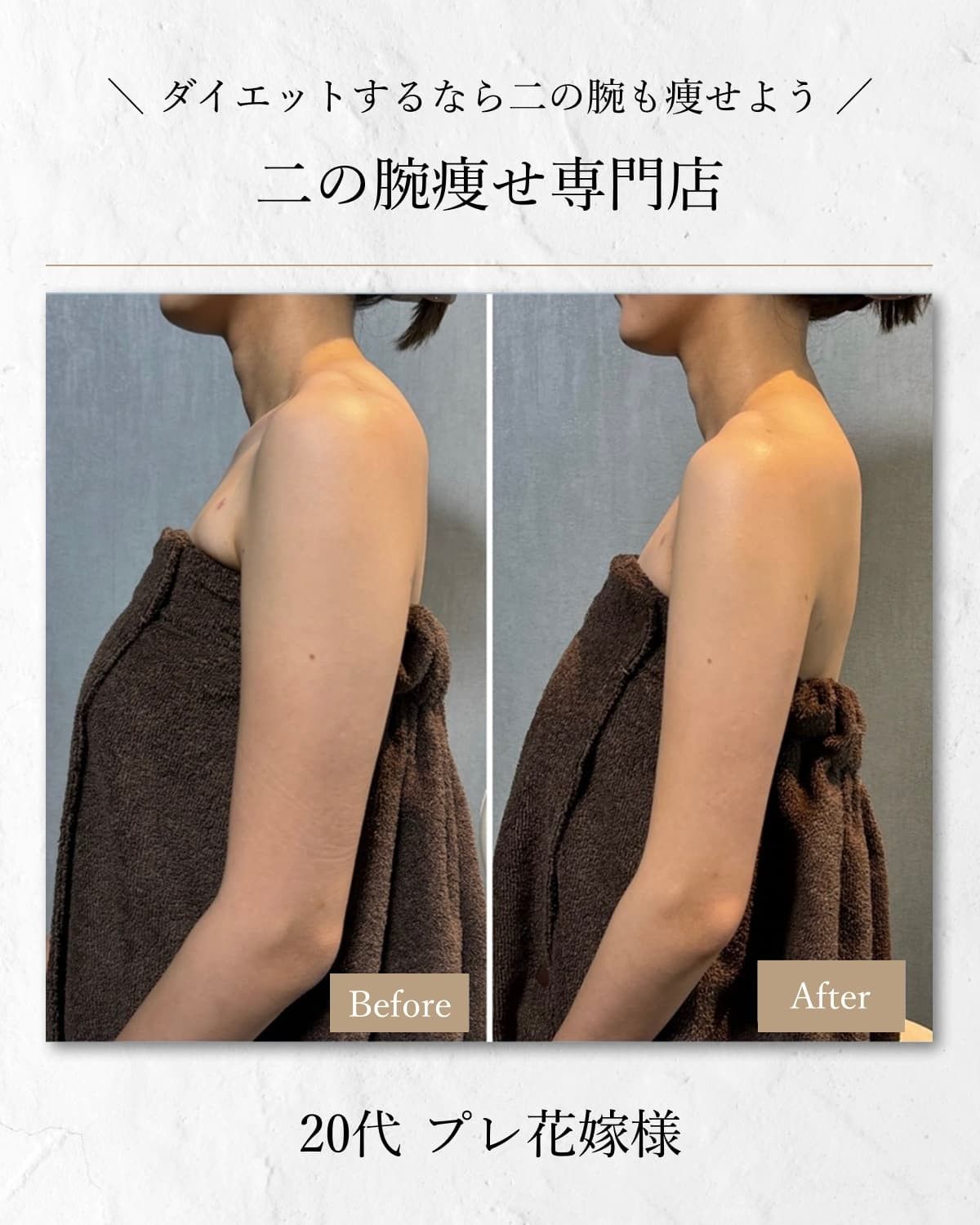 二の腕デザイン