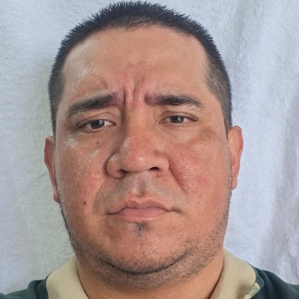 Aldo Cristobal Albán Valencia 