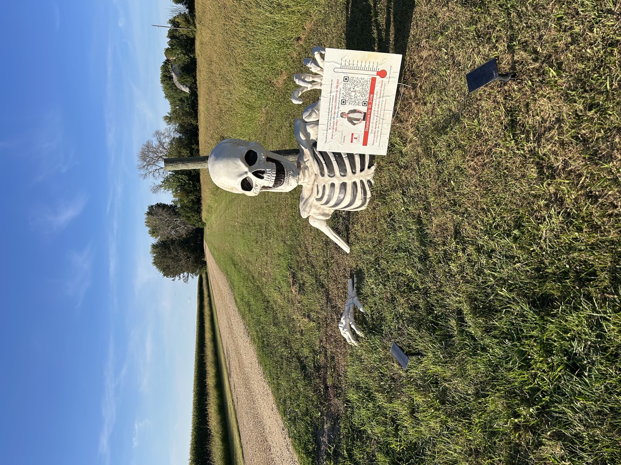 Sandmeyer’s skeleton for st jude