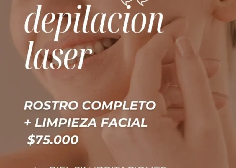 Depilación láser 