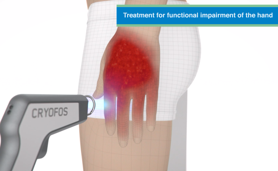 1e financieringsdoel van Pijnvrijleven Nederland BV