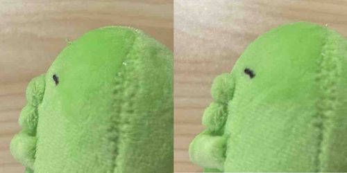 おでこの手術