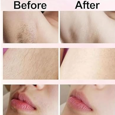 Beauty Bloom Electric Razor, Beauty Bloom 2.0, Beauty Bloom Trimmer, Beauty Bloom Razor 1