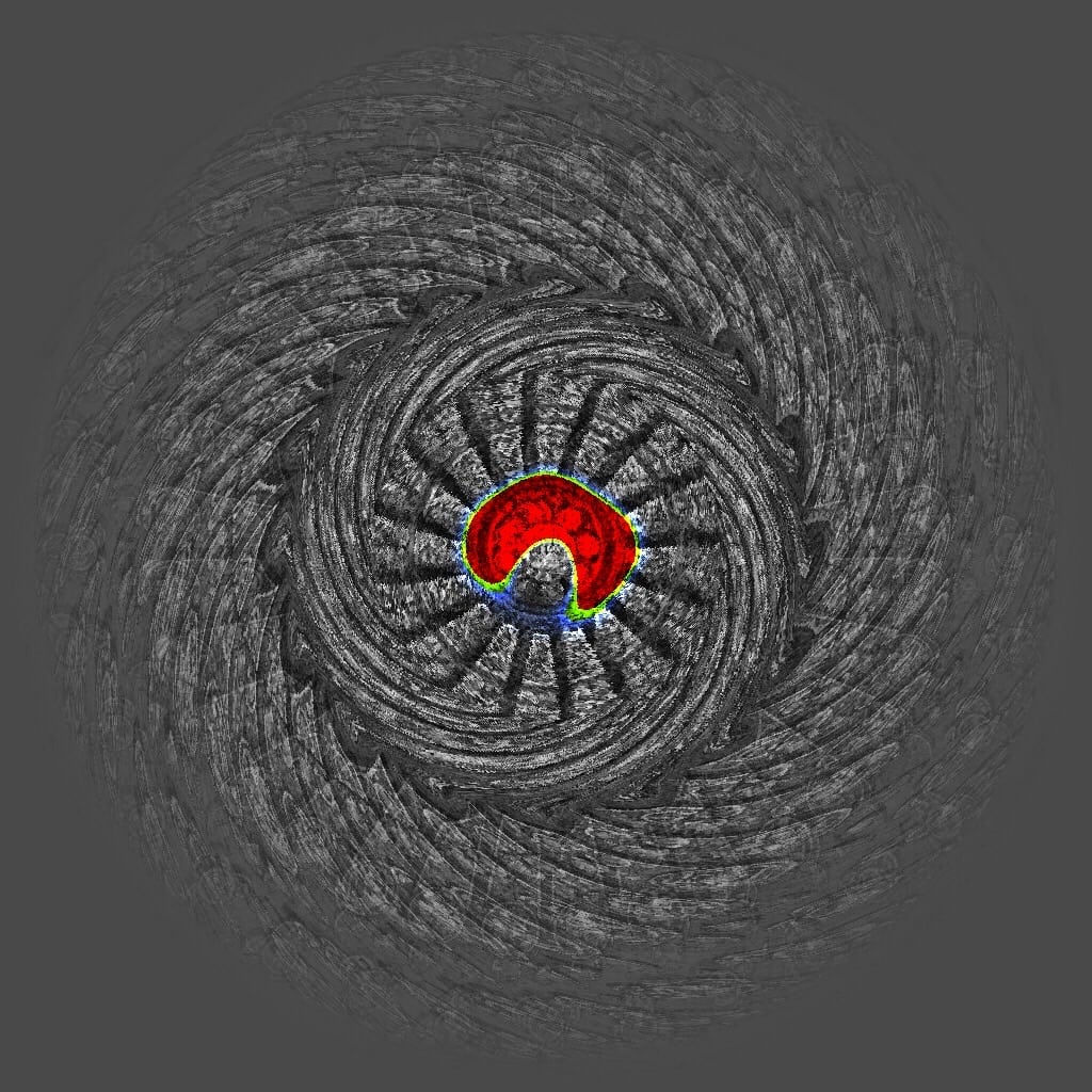 center blob