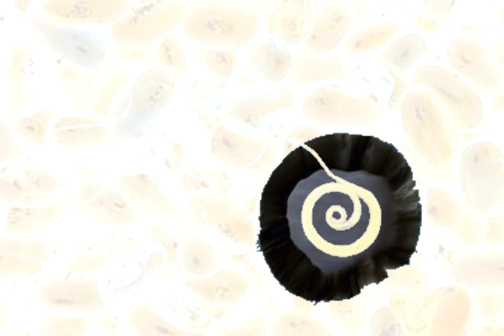 spiral out