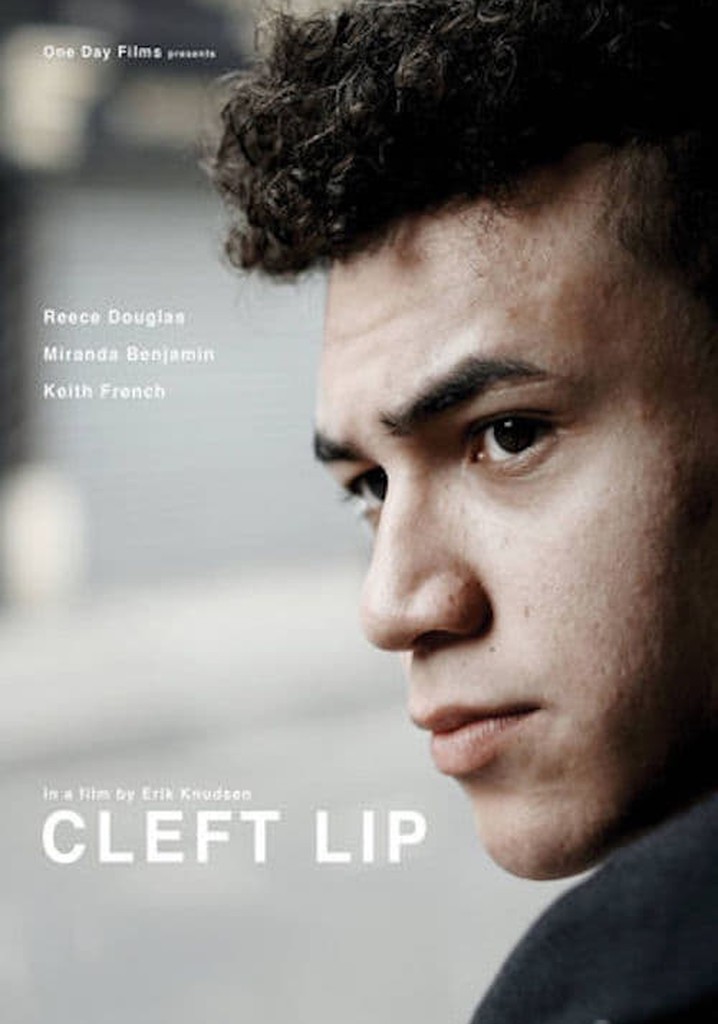 Cleft Lip poster